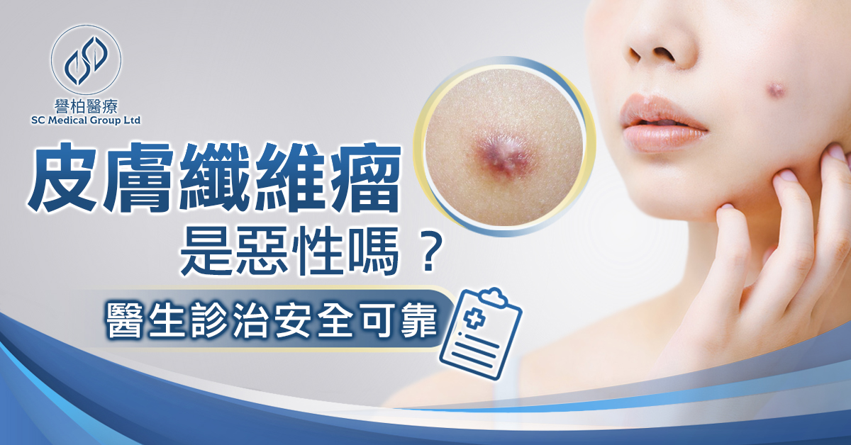 皮膚纖維瘤是惡性嗎 - 譽柏醫療中心 SC Medical